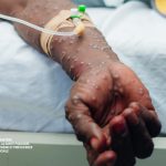 bitmap_1200_nocrop_1_1_20241028101048371137_Mpox